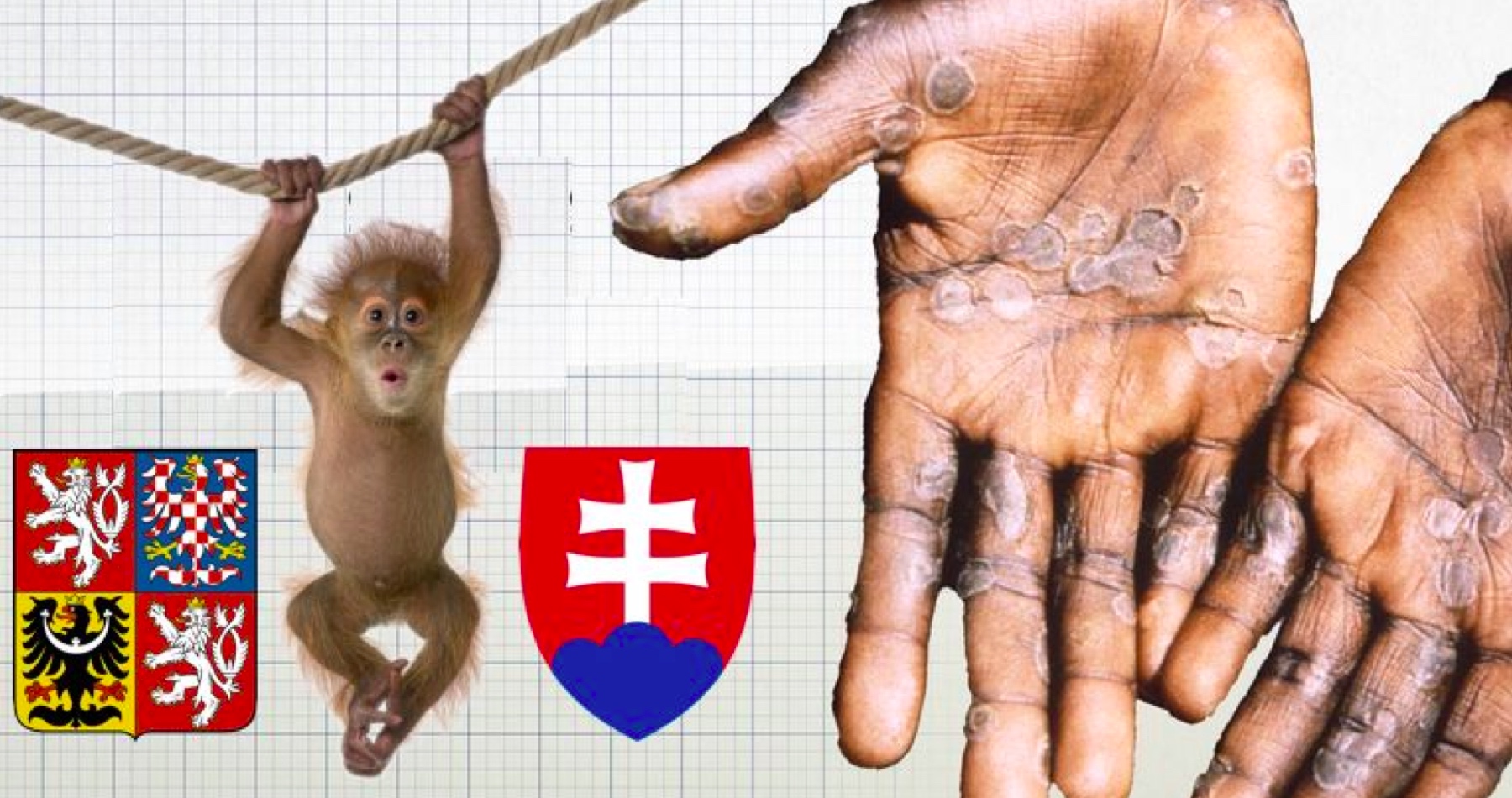 Proslov k národu a vyjádření k opičím neštovicím: Globalisté nás potřebují vyděsit něčím novým!